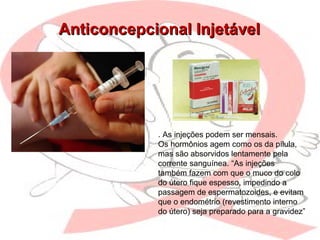 Anticoncepcional InjetávelAnticoncepcional Injetável
. As injeções podem ser mensais.
Os hormônios agem como os da pílula,
mas são absorvidos lentamente pela
corrente sanguínea. “As injeções
também fazem com que o muco do colo
do útero fique espesso, impedindo a
passagem de espermatozoides, e evitam
que o endométrio (revestimento interno
do útero) seja preparado para a gravidez”
 