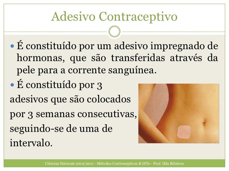 O Método Contraceptivo Tratado Nesse Texto é Denominado