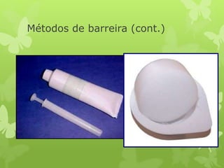 Métodos de barreira (cont.)
 ESPERMATICIDA
São substâncias que, colocadas na vagina, retardam a
passagem dos espermatozoides pelo canal cervical,
impedindo sua ascensão em direção ao ovócito para a
fecundação.
Apenas recomendado com o diafragma ou com os
preservativos, pois isoladamente tem alto índice de falha.
 