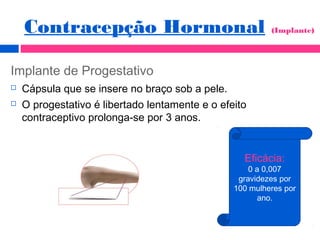 Implante de Progestativo
 Cápsula que se insere no braço sob a pele.
 O progestativo é libertado lentamente e o efeito
contraceptivo prolonga-se por 3 anos.
Eficácia:
0 a 0,007
gravidezes por
100 mulheres por
ano.
Contracepção Hormonal (Implante)
 
