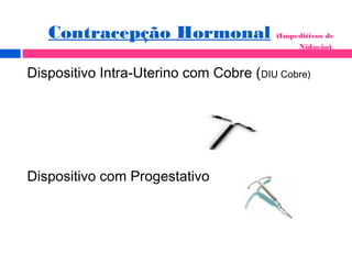 Contracepção Hormonal (Impeditivos de
Nidação)
Dispositivo Intra-Uterino com Cobre (DIU Cobre)
Dispositivo com Progestativo
 