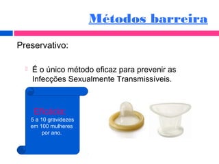 Métodos barreira
Preservativo:
 É o único método eficaz para prevenir as
Infecções Sexualmente Transmissíveis.
Eficácia:
5 a 10 gravidezes
em 100 mulheres
por ano.
 