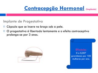 Implante de Progestativo Cápsula que se insere no braço sob a pele. O progestativo é libertado lentamente e o efeito contraceptivo prolonga-se por 3 anos. Eficácia: 0 a 0,007 gravidezes por 100 mulheres por ano. Contracepção Hormonal   (Implante)  