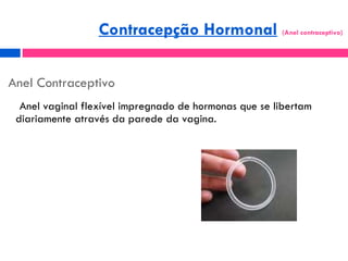 Anel Contraceptivo <ul><li>Anel vaginal flexível impregnado de hormonas que se libertam diariamente através da parede da v...