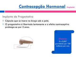Implante de Progestativo ,[object Object],[object Object],Eficácia: 0 a 0,007 gravidezes por 100 mulheres por ano. Contracepção Hormonal   (Implante)  