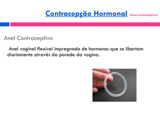 Anel Contraceptivo ,[object Object],Contracepção Hormonal   (Anel contraceptivo)  