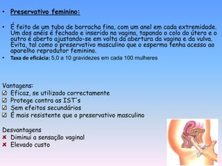 • Preservativo feminino:

• É feito de um tubo de borracha fina, com um anel em cada extremidade.
  Um dos anéis é fechado e inserido na vagina, tapando o colo do útero e o
  outro é aberto ajustando-se em volta da abertura da vagina e da vulva.
  Evita, tal como o preservativo masculino que o esperma tenha acesso ao
  aparelho reprodutor feminino.
•   Taxa de eficácia: 5,0 a 10 gravidezes em cada 100 mulheres



Vantagens:
  Eficaz, se utilizado correctamente
  Protege contra as IST's
  Sem efeitos secundários
  É mais resistente que o preservativo masculino

Desvantagens
  Diminui a sensação vaginal
  Elevado custo
 