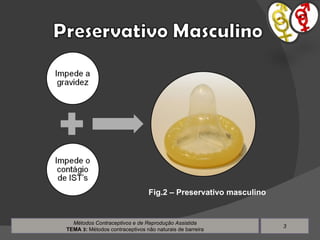 Métodos Contraceptivos e de Reprodução Assistida TEMA  3 :  Métodos contraceptivos não naturais de barreira Fig.2 – Preservativo masculino 
