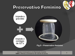 Métodos Contraceptivos e de Reprodução Assistida TEMA  3 :  Métodos contraceptivos não naturais de barreira Fig.5 – Preservativo feminino 