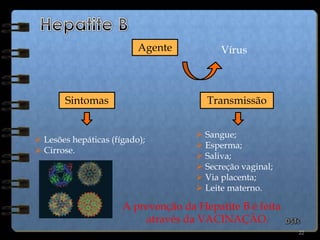 15Doenças Sexualmente Transmissíveis (DSTs)Gonorreia;