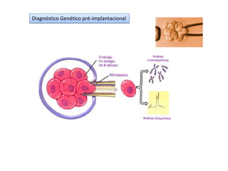 Diagnóstico Genético pré-implantacional

 