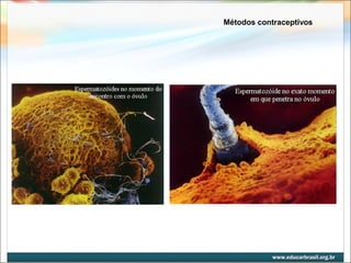 Métodos contraceptivos 
 