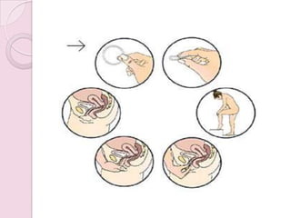  Segue-se um intervalo de uma semana.