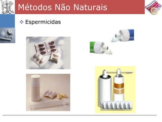 Métodos Não Naturais
 Espermicidas
 