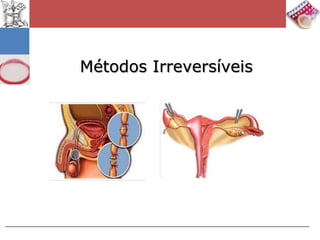 Métodos Irreversíveis
 