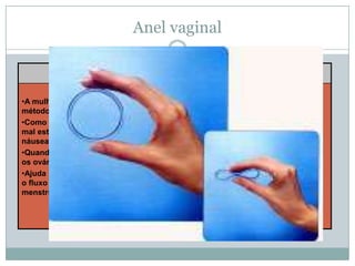 Anel vaginal
Vantagens
•A mulher não precisa de utilizar outros
métodos na relação sexual.
•Como é colocado na vagina não causa
mal estar estomacal, nem vómitos ou
náuseas.
•Quando suspenso o uso do anel vaginal,
os ovários voltam à sua função normal.
•Ajuda a regular o ciclo menstrual, diminui
o fluxo menstrual e alivia as dores
menstruais.

Desvantagens
•É contra indicado para mulheres
com mais de 35 anos e fumadoras.
•Não previne contra as DST.
•Duração de um mês.

 