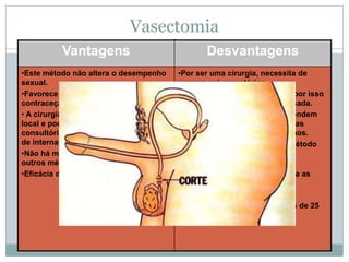 Vasectomia
Vantagens
•Este método não altera o desempenho
sexual.
•Favorece a participação do homem na
contraceção.
• A cirurgia é simples, com anestesia
local e pode ser realizada em
consultório não havendo necessidade
de internamento.
•Não há mais necessidade de uso de
outros métodos contracetivos.
•Eficácia de 100%

Desvantagens
•Por ser uma cirurgia, necessita de
exames pré operatórios.
•A cirurgia é de difícil reversão por isso
deve ser uma escolha bem pensada.
•Há muitos casais que se arrependem
ou homens que casam com novas
parceiras que desejariam ter filhos.
• É necessário o uso de outro método
contra a gravidez nas próximas
ejaculações após a cirurgia.
•Este método não protege contra as
DST.
•Método irreversível
•Apenas para homens com mais de 25
anos

 