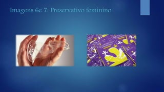 Imagens 6e 7: Preservativo feminino
 