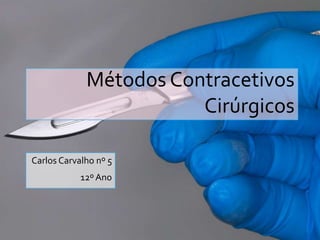 Métodos Contracetivos
Cirúrgicos
Carlos Carvalho nº 5
12º Ano
 