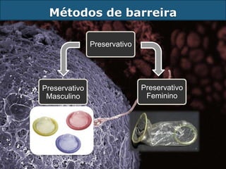 Métodos de barreira

               Preservativo




Preservativo                  Preservativo
 Masculino                     Feminino
 