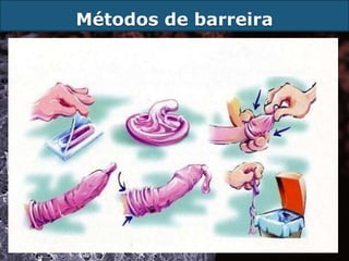 Métodos de barreira
 