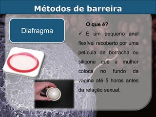 Métodos de barreira
               O que é?
Diafragma    É um pequeno anel
            flexível recoberto por uma
            película de borracha ou
            silicone que a mulher
            coloca   no   fundo    da
            vagina até 5 horas antes
            da relação sexual.
 