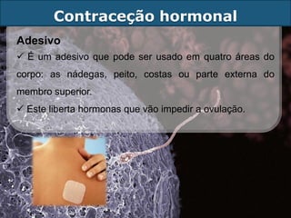 Contraceção hormonal
Adesivo
 É um adesivo que pode ser usado em quatro áreas do
corpo: as nádegas, peito, costas ou parte externa do
membro superior.
 Este liberta hormonas que vão impedir a ovulação.
 