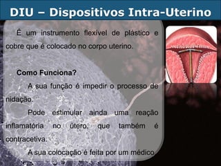 DIU – Dispositivos Intra-Uterino
   É um instrumento flexível de plástico e
cobre que é colocado no corpo uterino.


   Como Funciona?
      A sua função é impedir o processo de
nidação.
      Pode estimular ainda uma reação
inflamatória    no   útero,   que   também   é
contracetiva.
      A sua colocação é feita por um médico.
 