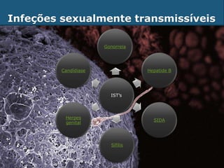 Infeções sexualmente transmissíveis

                      Gonorreia




         Candídiase               Hepatide B




                        IST’s




          Herpes
                                    SIDA
          genital




                        Sífilis
 