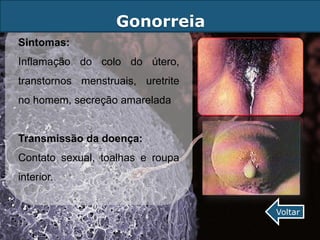Gonorreia
Sintomas:
Inflamação do colo do útero,
transtornos menstruais, uretrite
no homem, secreção amarelada


Transmissão da doença:
Contato sexual, toalhas e roupa
interior.


                                   Voltar
 