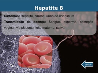 Hepatite B
Sintomas: Hepatite, cirrose, urina de cor escura.
Transmissão da doença: Sangue, esperma, secreção
vaginal, via placenta, leite materno, saliva.




                                                    Voltar
 
