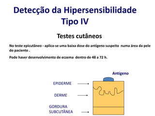 Detecção da Hipersensibilidade
Tipo IV
Testes cutâneos
No teste epicutâneo - aplica-se uma baixa dose do antígeno suspeito numa área da pele
do paciente .
Pode haver desenvolvimento de eczema dentro de 48 a 72 h.
EPIDERME
DERME
GORDURA
SUBCUTÂNEA
Antígeno
 