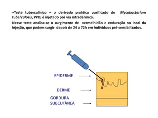 EPIDERME
DERME
GORDURA
SUBCUTÂNEA
•Teste tuberculínico – o derivado protéico purificado de Mycobacterium
tuberculosis, PPD, é injetado por via intradérmica.
Nesse teste analisa-se o surgimento de vermelhidão e enduração no local da
injeção, que podem surgir depois de 24 a 72h em indivíduos pré-sensibilizados.
 