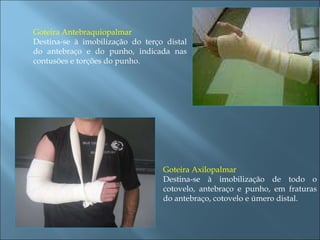 Goteira Antebraquiopalmar Destina-se à imobilização do terço distal do antebraço e do punho, indicada nas contusões e torções do punho. Goteira Axilopalmar Destina-se à imobilização de todo o cotovelo, antebraço e punho, em fraturas do antebraço, cotovelo e úmero distal. 