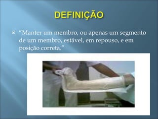 “ Manter um membro, ou apenas um segmento de um membro, estável, em repouso, e em posição correta.” 