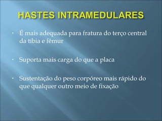 É mais adequada para fratura do terço central da tíbia e fêmur Suporta mais carga do que a placa Sustentação do peso corpóreo mais rápido do que qualquer outro meio de fixação 