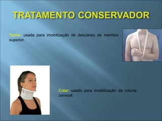 Tipóia:  usada para imobilização de descanso de membro superior. Colar:  usado para imobilização da coluna cervical. 