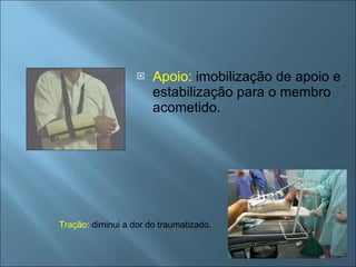 Apoio:  imobilização de apoio e estabilização para o membro acometido. Tração:  diminui a dor do traumatizado. 