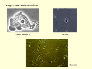 Imagens com contraste de fase




         Parasita Naegleria sp.   Neurônio




                                             Fribroblasto
 
