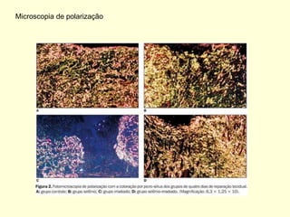 Microscopia de polarização
 