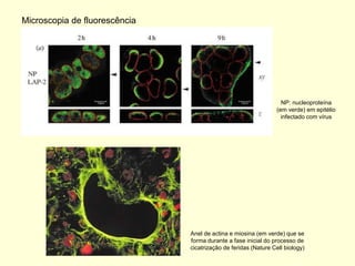 Microscopia de fluorescência




                                                                   NP: nucleoproteína
                                                                 (em verde) em epitélio
                                                                   infectado com vírus




                               Anel de actina e miosina (em verde) que se
                               forma durante a fase inicial do processo de
                               cicatrização de feridas (Nature Cell biology)
 