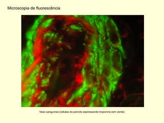 Microscopia de fluorescência




                Vaso sanguíneo (células do pericito espressando troponina (em verde)
 