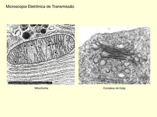 Microscopia Eletrônica de Transmissão




               Mitocôndria              Complexo de Golgi
 