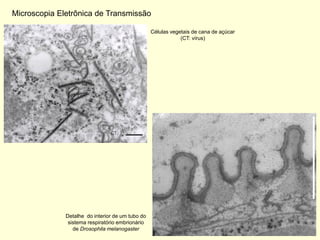 Microscopia Eletrônica de Transmissão

                                                  Células vegetais de cana de açúcar
                                                              (CT: vírus)




              Detalhe do interior de um tubo do
               sistema respiratório embrionário
                 de Drosophila melanogaster
 