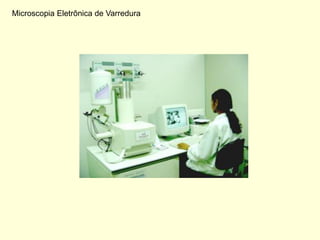 Microscopia Eletrônica de Varredura
 