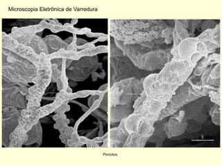 Microscopia Eletrônica de Varredura




                                      Pericitos
 
