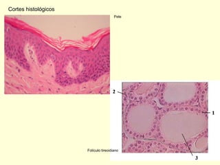 Cortes histológicos
                                       Pele




                      Folículo tireoidiano
 