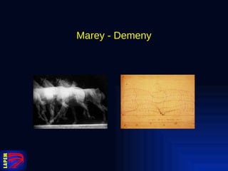 Marey - Demeny 