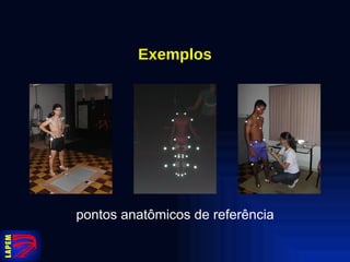 Exemplos pontos anatômicos de referência 