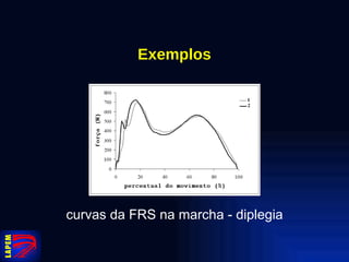 Exemplos curvas da FRS na marcha - diplegia 